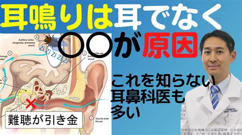 右耳 耳鳴|【医師監修】耳鳴りの種類ごとの原因を解説！自分で。